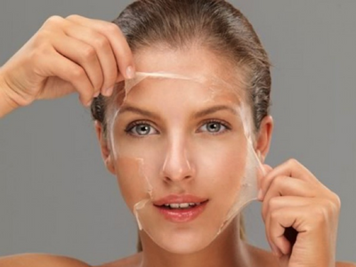 Everything you need to know about a Chemical Peel