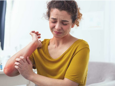 Skincare tips to manage eczema