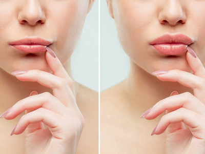 Insta-Worthy Pictures to Grow Your Lip Filler Business